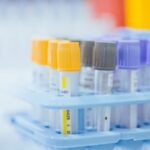 Professionnels de santé : du nouveau pour les examens biologiques